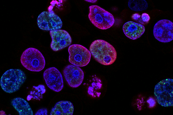 cancerceller